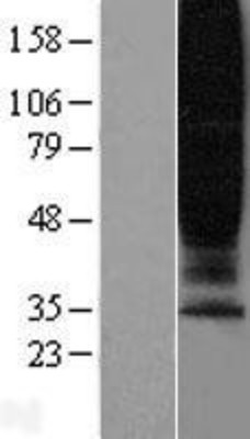 Western Blot: GPR45 Overexpression Lysate (Adult Normal) [NBL1-11282] Left-Empty vector transfected control cell lysate (HEK293 cell lysate); Right -Over-expression Lysate for GPR45.