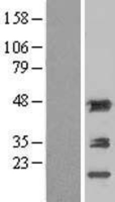 Western Blot: Aminoacylase 1 Overexpression Lysate (Adult Normal) [NBL1-07300] Left-Empty vector transfected control cell lysate (HEK293 cell lysate); Right -Over-expression Lysate for Aminoacylase 1.