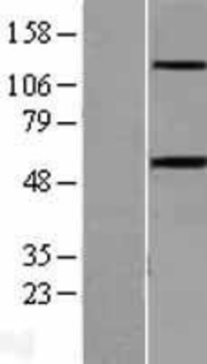 Western Blot: Activin Receptor Type 1B Overexpression Lysate (Adult Normal) [NBL1-07295] Left-Empty vector transfected control cell lysate (HEK293 cell lysate); Right -Over-expression Lysate for Activin Receptor Type 1B.