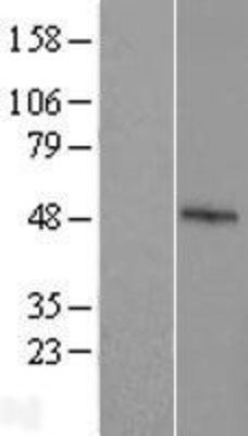 Western Blot: FBXO39 Overexpression Lysate (Adult Normal) [NBL1-10634] Left-Empty vector transfected control cell lysate (HEK293 cell lysate); Right -Over-expression Lysate for FBXO39.