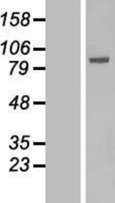 Western Blot: Solo Overexpression Lysate (Adult Normal) [NBL1-15866] Left-Empty vector transfected control cell lysate (HEK293 cell lysate); Right -Over-expression Lysate for Solo.