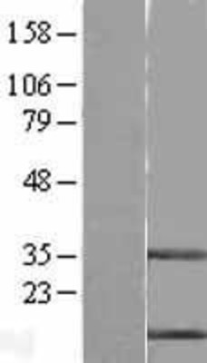 Western Blot: Stefin B Overexpression Lysate (Adult Normal) [NBL1-09554] Left-Empty vector transfected control cell lysate (HEK293 cell lysate); Right -Over-expression Lysate for Stefin B.