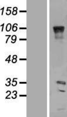 Western Blot: VENTX Overexpression Lysate (Adult Normal) [NBP2-07327] Left-Empty vector transfected control cell lysate (HEK293 cell lysate); Right -Over-expression Lysate for VENTX.