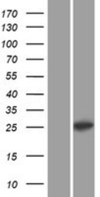 Western Blot: C1QL1 Overexpression Lysate (Adult Normal) [NBP2-07593] Left-Empty vector transfected control cell lysate (HEK293 cell lysate); Right -Over-expression Lysate for C1QL1.