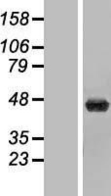 Western Blot: beta ureidopropionase Overexpression Lysate (Adult Normal) [NBP2-07056] Left-Empty vector transfected control cell lysate (HEK293 cell lysate); Right -Over-expression Lysate for beta ureidopropionase.