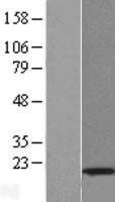 Western Blot: ISG15 Overexpression Lysate (Adult Normal) [NBL1-12046] Left-Empty vector transfected control cell lysate (HEK293 cell lysate); Right -Over-expression Lysate for ISG15.