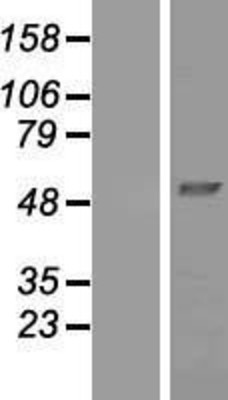 Western Blot: NDUFV1 Overexpression Lysate (Adult Normal) [NBP2-07531] Left-Empty vector transfected control cell lysate (HEK293 cell lysate); Right -Over-expression Lysate for NDUFV1.