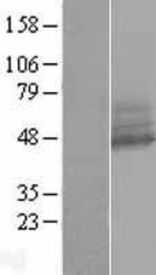 Western Blot: RNF167 Overexpression Lysate (Adult Normal) [NBP2-07157] Left-Empty vector transfected control cell lysate (HEK293 cell lysate); Right -Over-expression Lysate for RNF167.