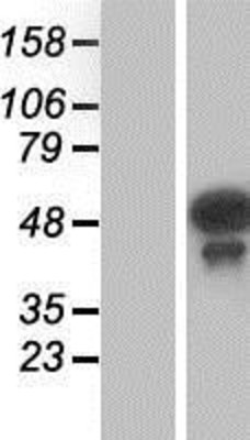 Western Blot: Testin Overexpression Lysate (Adult Normal) [NBP2-07137] Left-Empty vector transfected control cell lysate (HEK293 cell lysate); Right -Over-expression Lysate for Testin.