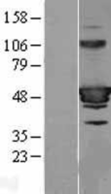 Western Blot: HIC5 Overexpression Lysate (Adult Normal) [NBL1-16853] Left-Empty vector transfected control cell lysate (HEK293 cell lysate); Right -Over-expression Lysate for HIC5.