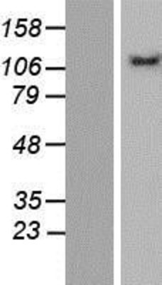 Western Blot: VPS54 Overexpression Lysate (Adult Normal) [NBP2-07030] Left-Empty vector transfected control cell lysate (HEK293 cell lysate); Right -Over-expression Lysate for VPS54.