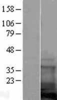 Western Blot: COTL1 Overexpression Lysate (Adult Normal) [NBL1-09402] Left-Empty vector transfected control cell lysate (HEK293 cell lysate); Right -Over-expression Lysate for COTL1.