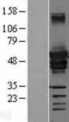 Western Blot: Desmin Overexpression Lysate (Adult Normal) [NBL1-09840] - Western Blot experiments.  Left-Control; Right -Over-expression Lysate for DES