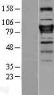 Western Blot: ZNF408 Overexpression Lysate (Adult Normal) [NBL1-18143] Left-Empty vector transfected control cell lysate (HEK293 cell lysate); Right -Over-expression Lysate for ZNF408.