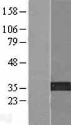Western Blot: KIF25 Overexpression Lysate (Adult Normal) [NBP2-07761] Left-Empty vector transfected control cell lysate (HEK293 cell lysate); Right -Over-expression Lysate for KIF25.