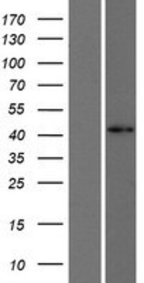 Western Blot: FOXD4L1 Overexpression Lysate (Adult Normal) [NBP2-07482] Left-Empty vector transfected control cell lysate (HEK293 cell lysate); Right -Over-expression Lysate for FOXD4L1.