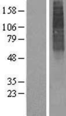 Western Blot: ALG3 Overexpression Lysate (Adult Normal) [NBP2-07704] Left-Empty vector transfected control cell lysate (HEK293 cell lysate); Right -Over-expression Lysate for ALG3.