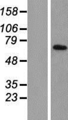 Western Blot: TIMM44 Overexpression Lysate (Adult Normal) [NBP2-07635] Left-Empty vector transfected control cell lysate (HEK293 cell lysate); Right -Over-expression Lysate for TIMM44.