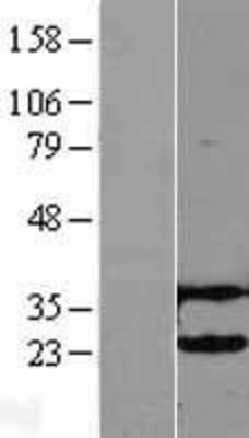 Western Blot: UBE2H Overexpression Lysate (Adult Normal) [NBL1-17531] Left-Empty vector transfected control cell lysate (HEK293 cell lysate); Right -Over-expression Lysate for UBE2H.
