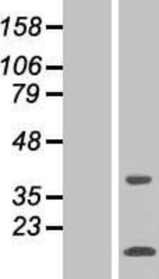 Western Blot: SNAPC5 Overexpression Lysate (Adult Normal) [NBP2-07678] Left-Empty vector transfected control cell lysate (HEK293 cell lysate); Right -Over-expression Lysate for SNAPC5.