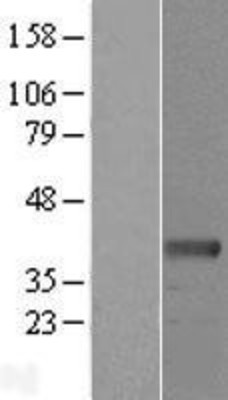 Western Blot: RDH10 Overexpression Lysate (Adult Normal) [NBL1-15254] Left-Empty vector transfected control cell lysate (HEK293 cell lysate); Right -Over-expression Lysate for RDH10.