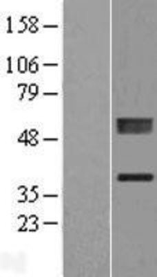 Western Blot: PLCXD1 Overexpression Lysate (Adult Normal) [NBL1-14493] Left-Empty vector transfected control cell lysate (HEK293 cell lysate); Right -Over-expression Lysate for PLCXD1.