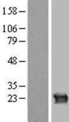 Western Blot: CRYGB Overexpression Lysate (Adult Normal) [NBP2-07779] Left-Empty vector transfected control cell lysate (HEK293 cell lysate); Right -Over-expression Lysate for CRYGB.