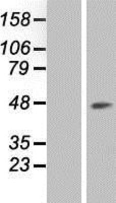 Western Blot: RCL1 Overexpression Lysate (Adult Normal) [NBP2-07701] Left-Empty vector transfected control cell lysate (HEK293 cell lysate); Right -Over-expression Lysate for RCL1.