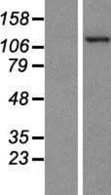 Western Blot: PKN2 Overexpression Lysate (Adult Normal) [NBP2-07651] Left-Empty vector transfected control cell lysate (HEK293 cell lysate); Right -Over-expression Lysate for PKN2.