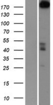 Western Blot: PARP4 Overexpression Lysate (Adult Normal) [NBP2-07619] Left-Empty vector transfected control cell lysate (HEK293 cell lysate); Right -Over-expression Lysate for PARP4.