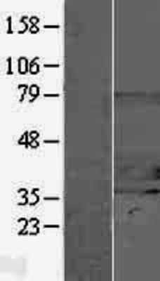 Western Blot: CHIP Overexpression Lysate (Adult Normal) [NBP2-07696] Left-Empty vector transfected control cell lysate (HEK293 cell lysate); Right -Over-expression Lysate for CHIP.