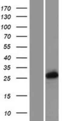 Western Blot: PCGF3 Overexpression Lysate (Adult Normal) [NBP2-07642] Left-Empty vector transfected control cell lysate (HEK293 cell lysate); Right -Over-expression Lysate for PCGF3.