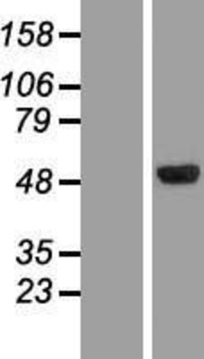 Western Blot: CLN5 Overexpression Lysate (Adult Normal) [NBP2-07612] Left-Empty vector transfected control cell lysate (HEK293 cell lysate); Right -Over-expression Lysate for CLN5.