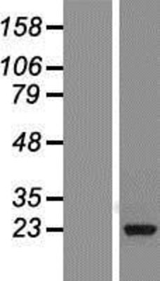 Western Blot: Ran Overexpression Lysate (Adult Normal) [NBP2-07637] Left-Empty vector transfected control cell lysate (HEK293 cell lysate); Right -Over-expression Lysate for Ran.