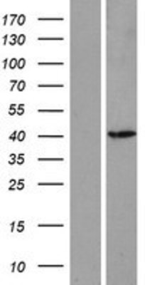 Western Blot: ASMT Overexpression Lysate (Adult Normal) [NBP2-07921] Left-Empty vector transfected control cell lysate (HEK293 cell lysate); Right -Over-expression Lysate for ASMT.
