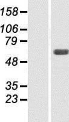 Western Blot: SNX4 Overexpression Lysate (Adult Normal) [NBP2-07953] Left-Empty vector transfected control cell lysate (HEK293 cell lysate); Right -Over-expression Lysate for SNX4.