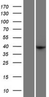 Western Blot: FEZ2 Overexpression Lysate (Adult Normal) [NBP2-07794] Left-Empty vector transfected control cell lysate (HEK293 cell lysate); Right -Over-expression Lysate for FEZ2.
