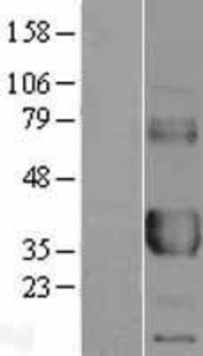 Western Blot: FCGR2A Overexpression Lysate (Adult Normal) [NBL1-10655] Left-Empty vector transfected control cell lysate (HEK293 cell lysate); Right -Over-expression Lysate for FCGR2A.