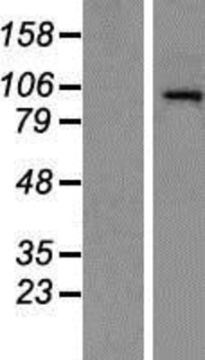Western Blot: HDAC7 Overexpression Lysate (Adult Normal) [NBP2-07000] Left-Empty vector transfected control cell lysate (HEK293 cell lysate); Right -Over-expression Lysate for HDAC7.
