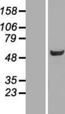 Western Blot: BIVM Overexpression Lysate (Adult Normal) [NBP2-06939] Left-Empty vector transfected control cell lysate (HEK293 cell lysate); Right -Over-expression Lysate for BIVM.