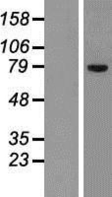 Western Blot: SLCO1C1 Overexpression Lysate (Adult Normal) [NBP2-06985] Left-Empty vector transfected control cell lysate (HEK293 cell lysate); Right -Over-expression Lysate for SLCO1C1.