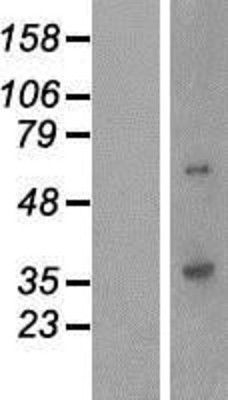 Western Blot: QPCTL Overexpression Lysate (Adult Normal) [NBP2-06952] Left-Empty vector transfected control cell lysate (HEK293 cell lysate); Right -Over-expression Lysate for QPCTL.