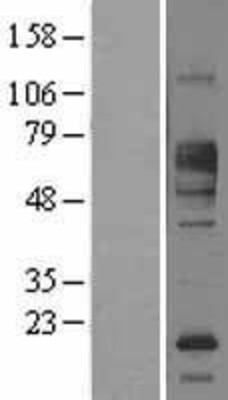 Western Blot: FCRL1 Overexpression Lysate (Adult Normal) [NBL1-10664] Left-Empty vector transfected control cell lysate (HEK293 cell lysate); Right -Over-expression Lysate for FCRL1.