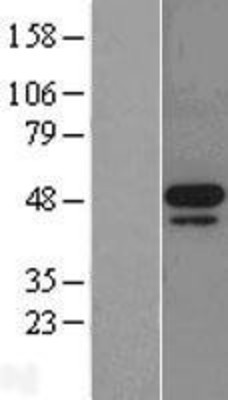 Western Blot: MNK2 Overexpression Lysate (Adult Normal) [NBL1-13125] Left-Empty vector transfected control cell lysate (HEK293 cell lysate); Right -Over-expression Lysate for MNK2.