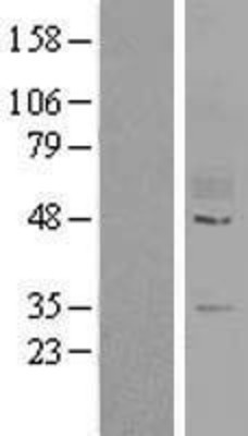 Western Blot: GPR78 Overexpression Lysate (Adult Normal) [NBL1-11293] Left-Empty vector transfected control cell lysate (HEK293 cell lysate); Right -Over-expression Lysate for GPR78.