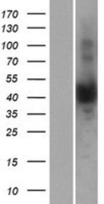 Western Blot: NUDT13 Overexpression Lysate (Adult Normal) [NBP2-07116] Left-Empty vector transfected control cell lysate (HEK293 cell lysate); Right -Over-expression Lysate for NUDT13.