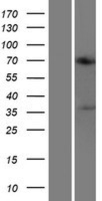 Western Blot: ACOT11 Overexpression Lysate (Adult Normal) [NBP2-07148] Left-Empty vector transfected control cell lysate (HEK293 cell lysate); Right -Over-expression Lysate for ACOT11.
