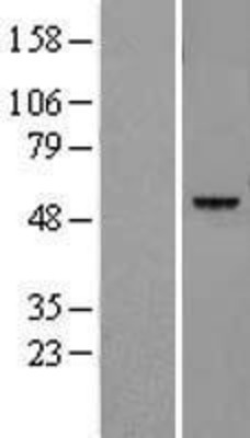 Western Blot: Legumain Overexpression Lysate (Adult Normal) [NBL1-12508] Left-Empty vector transfected control cell lysate (HEK293 cell lysate); Right -Over-expression Lysate for Legumain.