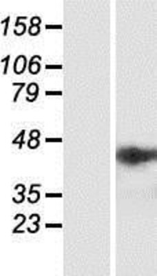 Western Blot: NSMCE4A Overexpression Lysate (Adult Normal) [NBP2-06957] Left-Empty vector transfected control cell lysate (HEK293 cell lysate); Right -Over-expression Lysate for NSMCE4A.
