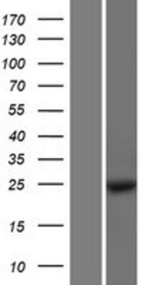 Western Blot: MOBKL1B Overexpression Lysate (Adult Normal) [NBP2-06844] Left-Empty vector transfected control cell lysate (HEK293 cell lysate); Right -Over-expression Lysate for MOBKL1B.